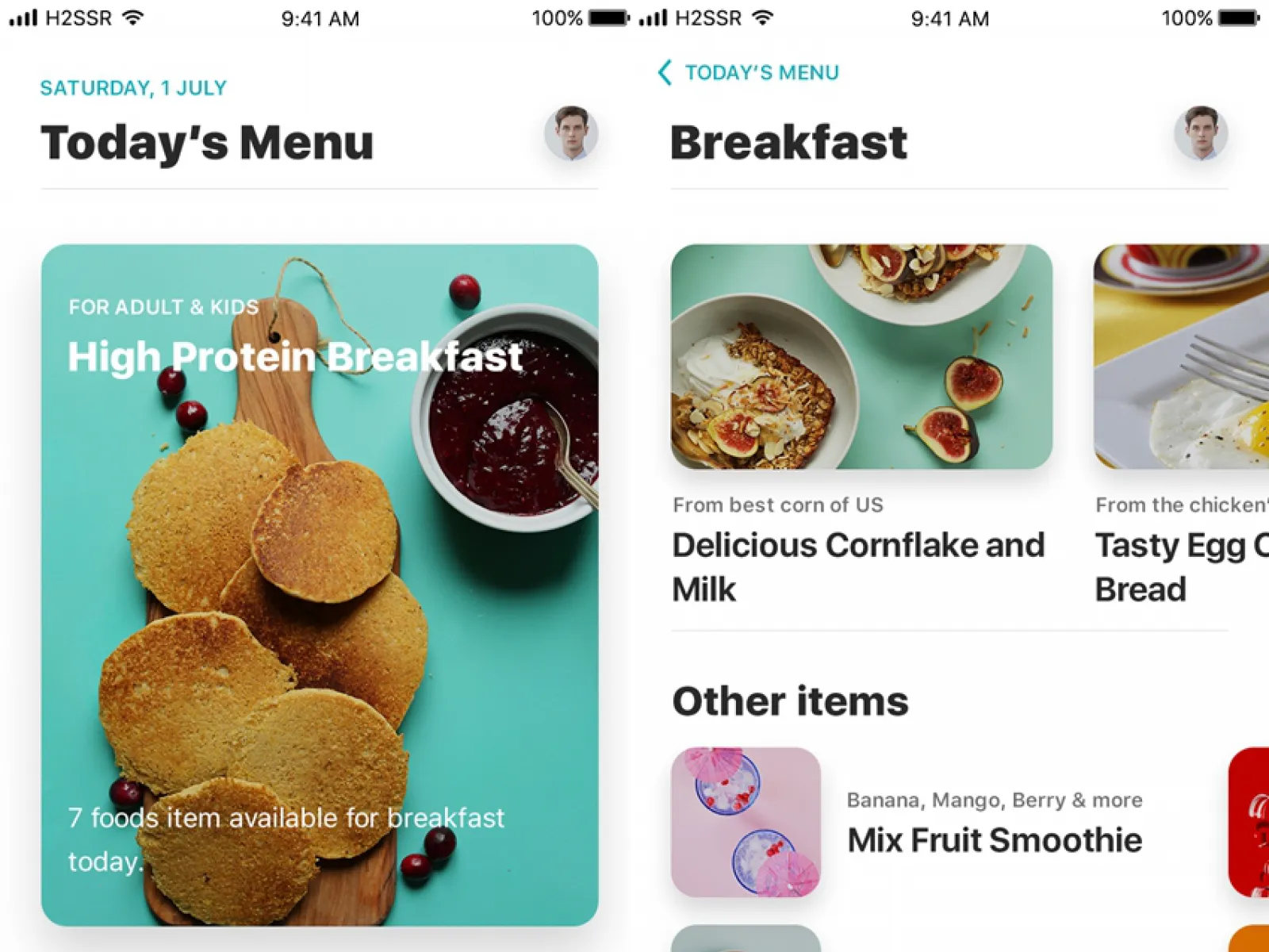 Food App Light Version  - Free Figma Template